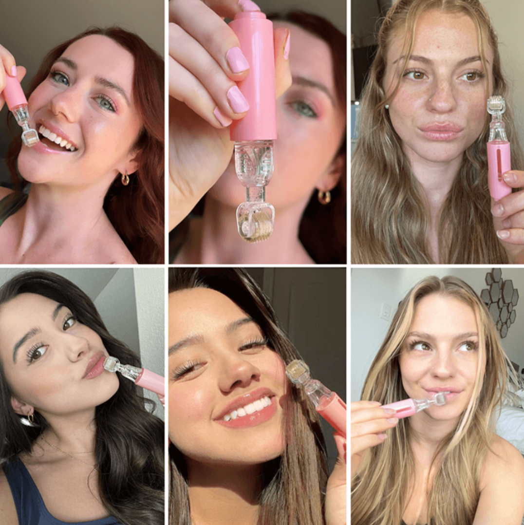 Lip Boost Roller® - Microneedling lèvres
